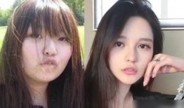 爆料闺蜜帮整容视频大全